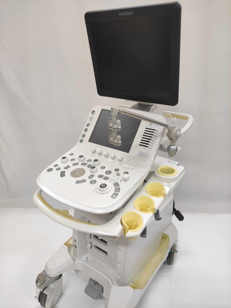 超音波診断装置｜ARIETTA 60｜日立製作所の写真1枚目