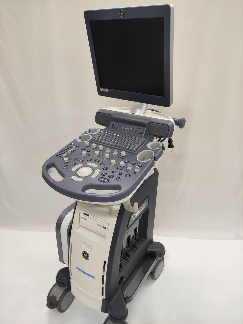 4D超音波診断装置（カラードプラ）｜Voluson P8｜GEヘルスケアの写真1枚目