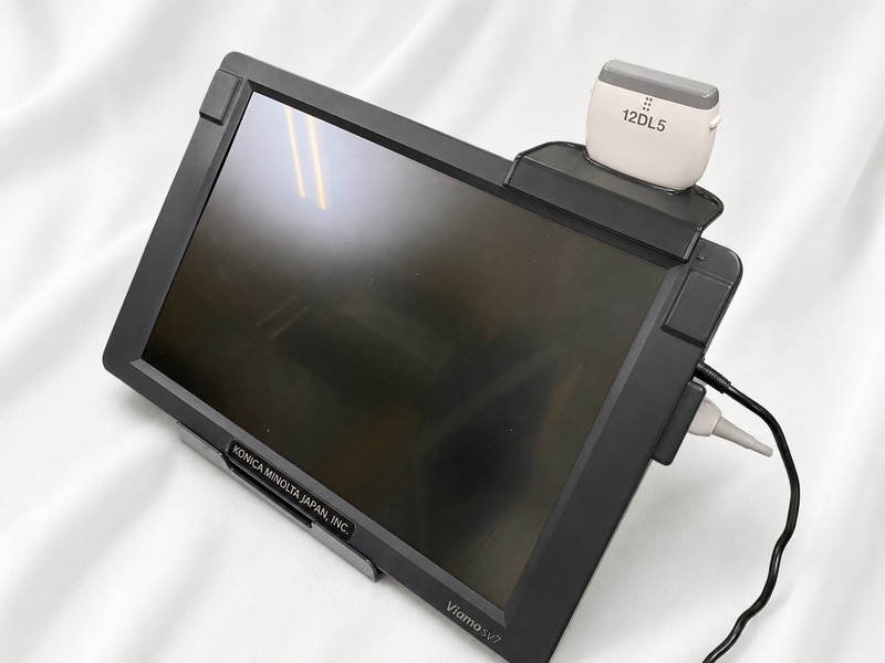 超音波診断装置｜Viamo SV7   CUS-VSV7｜キヤノンメディカルシステムズの写真1枚目