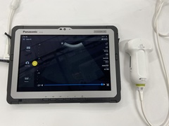 超音波診断装置｜｜フィリップスの１枚目写真