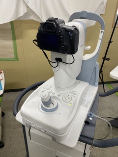 眼底カメラの１枚目写真