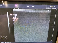 Ultrasound system(Color)｜EUB-5500｜Hitachi Medical photo2