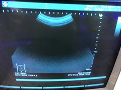 Ultrasound system(Color)｜SDU-1100｜Shimadzu photo2