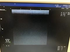 Ultrasound system(Color)｜UF-750XT｜Fukuda photo2