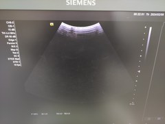 Ultrasound system｜ACUSON NX3｜Mochida Siemens Medical Systems photo2