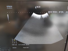 Ultrasound system｜ARIETTA 60｜Hitachi photo2