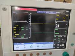 全身麻酔器｜Aespire View｜GEヘルスケアの写真2枚目