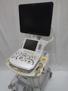 超音波診断装置（カラードプラ）｜ARIETTA 70｜日立製作所の写真2枚目
