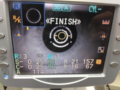 オートレフケラトメータ｜ARK-530A｜ニデックの写真2枚目