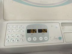 移動型X線撮影装置｜MobileArt Evolution｜島津製作所の写真2枚目