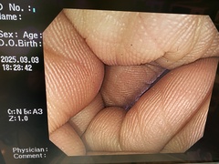 大腸ビデオスコープ｜CF-H260AZI｜オリンパスメディカルシステムズ株式会社の写真2枚目