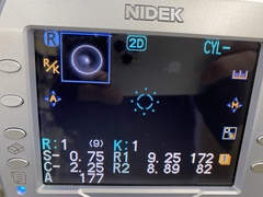 Autolef keratometer｜ARK-530A｜'' photo2