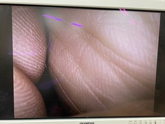 腹腔・胸腔ビデオスコープ｜WA50013A｜オリンパスメディカルシステムズ株式会社の写真2枚目