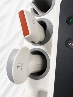 Ultrasound system(Color)｜EPIQ /Affiniti 70G｜Philips photo2