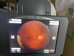 オート無散瞳眼底カメラ｜AFC-330｜ニデックの写真2枚目