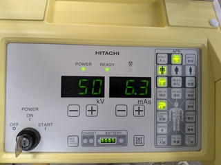 回診用X線撮影装置｜Sirius Star Mobile  130HP｜日立メディコの写真2枚目