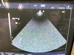Ultrasound system(Color)｜EUB-5500｜Hitachi Medical photo3