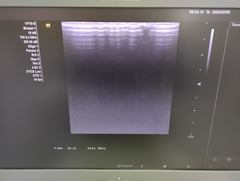 Ultrasound system｜ACUSON NX3｜Mochida Siemens Medical Systems photo3