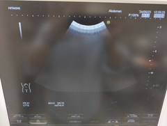 Ultrasound system(Color)｜HI VISION Avius｜Hitachi photo3