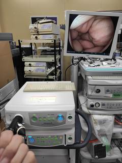 内視鏡光源＆プロセッサー装置｜VP-4450＆XL-4450｜富士フイルムメディカルの写真3枚目