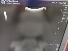 超音波診断装置（カラードプラ）｜LOGIQ V5 Expert｜GEヘルスケアの写真3枚目
