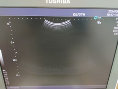 超音波診断装置（カラードプラ）｜SSA-590A  Nemio MX｜キヤノンメディカルシステムズの写真3枚目