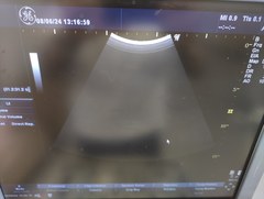 超音波診断装置（カラードプラ）｜LOGIQ P6｜GEヘルスケアの写真3枚目