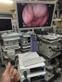 内視鏡光源＆プロセッサー装置｜VP-7000/LL-7000 LASEREO｜富士フイルムメディカルの写真3枚目