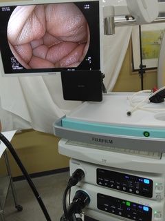 Processor & Light Source｜VP-7000/LL-7000 LASEREO｜Fujifilm Medical photo3