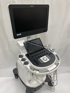 超音波診断装置｜Affiniti 50G｜フィリップスの写真3枚目