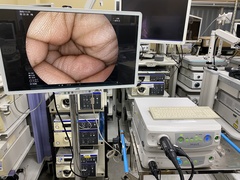 内視鏡光源＆プロセッサー装置｜VP-3500HD＆XL-4450｜富士フイルムメディカルの写真3枚目