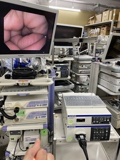 内視鏡光源＆プロセッサー装置｜CV-190PLUS＆CLV-190(EVIS EXERA Ⅲ)｜オリンパスメディカルシステムズ株式会社の写真3枚目