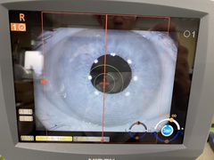 Optical Coherence Tomography｜RS-3000｜'' photo3