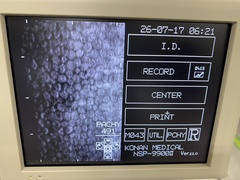 Specular microscope｜NSP-9900Ⅱ｜'' photo2
