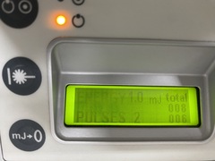 ヤグレーザー治療器｜Laserex SuperQ YAGレーザー｜エレックス株式会社の写真2枚目