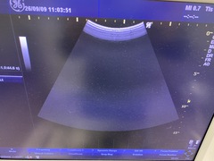 Ultrasound system｜LOGIQ A5｜GE Healthcare photo3