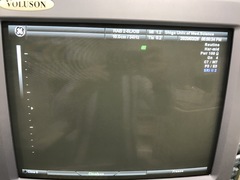 Ultrasound system(Color)｜Voluson 730 Expert｜GE Healthcare photo4