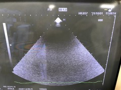 Ultrasound system(Color)｜HI VISION 900｜Hitachi Medical photo4