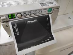 Ultrasound system｜ACUSON NX3｜Mochida Siemens Medical Systems photo4
