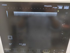 Ultrasound system(Color)｜HI VISION Avius｜Hitachi photo4
