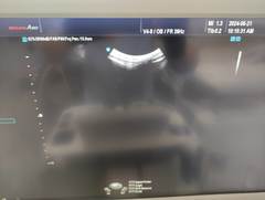 超音波画像診断装置｜ACCUVIX A30｜サムソン電子ジャパン株式会社の写真4枚目