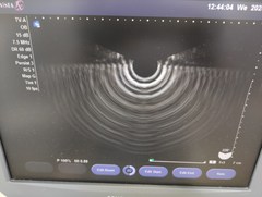 超音波診断装置（カラー）｜SONOVISTA FX｜持田シーメンスメディカルの写真4枚目