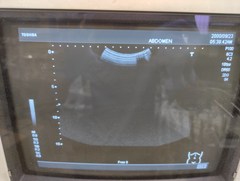 超音波診断装置（白黒）｜SSA-550A Nemio10｜キヤノンメディカルシステムズの写真4枚目