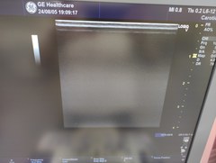 超音波診断装置（カラードプラ）｜LOGIQ V5 Expert｜GEヘルスケアの写真4枚目