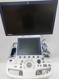 超音波診断装置｜LOGIQ P9｜GEヘルスケアの写真4枚目