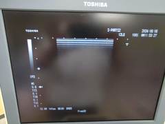 超音波診断装置（LCD)｜SSA-530A Famio8｜キヤノンメディカルシステムズの写真4枚目