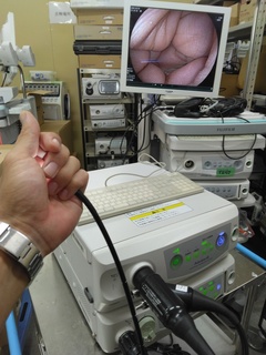 内視鏡光源＆プロセッサー装置｜VP-4450HD＆XL-4450｜富士フイルムメディカルの写真4枚目