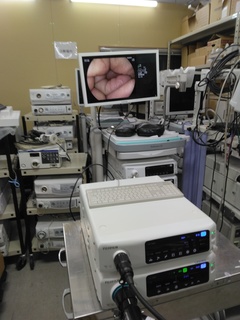 Processor & Light Source｜VP-7000/LL-7000 LASEREO｜Fujifilm Medical photo4