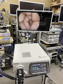 内視鏡一体型プロセッサ｜EPK-i7000｜ペンタックスの写真4枚目
