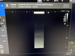 超音波診断装置｜Viamo SV7   CUS-VSV7｜キヤノンメディカルシステムズの写真4枚目
